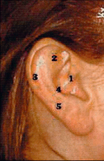 Ohrakupunktur: Anatomie des äußeren Ohrs