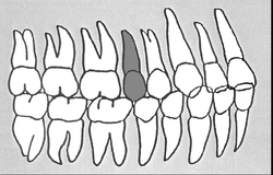 Zahn-Körper-Beziehungen Zahn 15