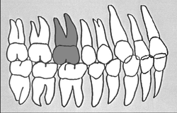 Zahn-Körper-Beziehungen Zahn 16