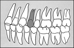 Zahn-Körper-Beziehungen Zahn 24