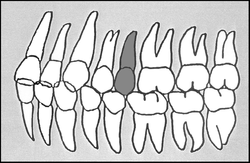 Zahn-Körper-Beziehungen Zahn 25