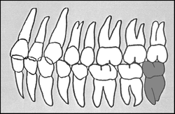 Zahn-Körper-Beziehungen Zahn 38